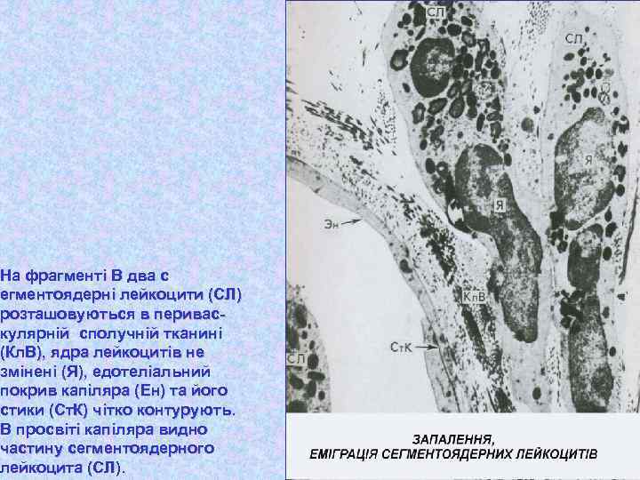 На фрагменті В два с егментоядерні лейкоцити (СЛ) розташовуються в периваскулярній сполучній тканині (Кл.