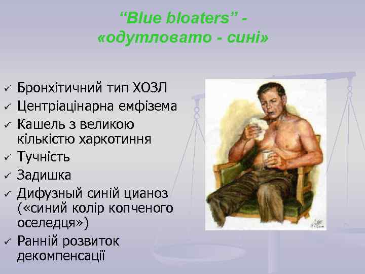 “Blue bloaters” «одутловато - сині» ü ü ü ü Бронхітичний тип ХОЗЛ Центріацінарна емфізема