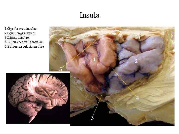 Insula 1. Gyri breves insulae 2. Gyri longi insulae 3. Limen insulae 4. Sulcus