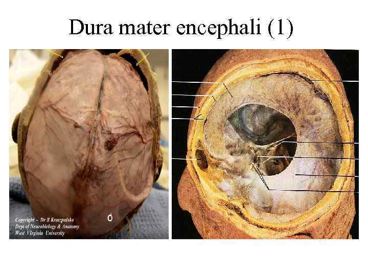 Dura mater encephali (1) 