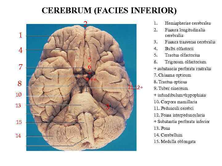 CEREBRUM (FACIES INFERIOR) 2 1. 2. 1 4 7 8 5 6 + 9