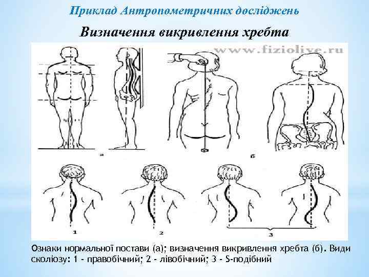 Приклад Антропометричних досліджень Визначення викривлення хребта Ознаки нормальної постави (а); визначення викривлення хребта (б).