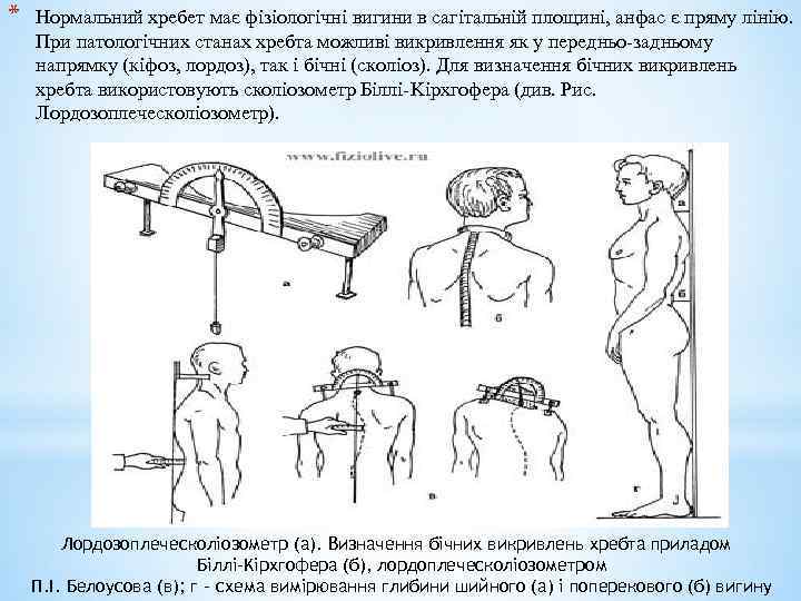 * Нормальний хребет має фізіологічні вигини в сагітальній площині, анфас є пряму лінію. При