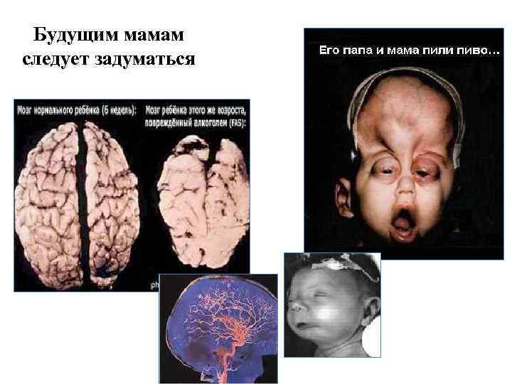 Будущим мамам следует задуматься 