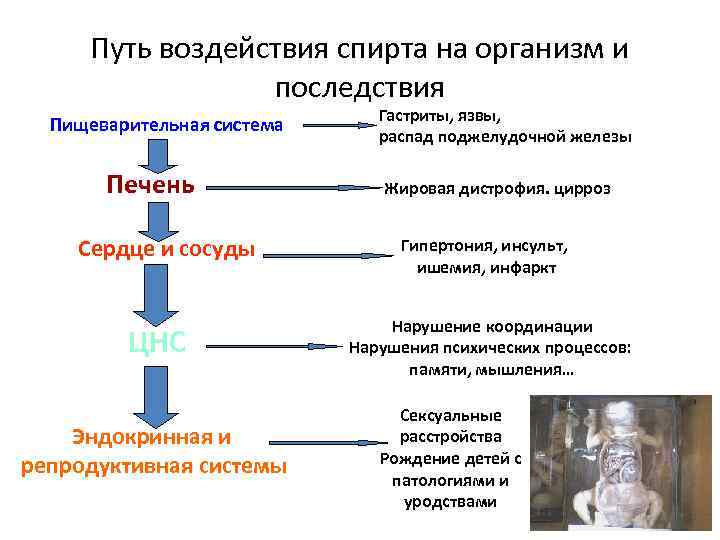 Путь воздействия спирта на организм и последствия Пищеварительная система Печень Сердце и сосуды ЦНС