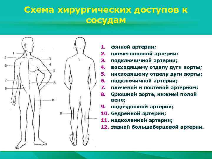 Схема хирургических доступов к сосудам 1. 2. 3. 4. 5. 6. 7. 8. сонной