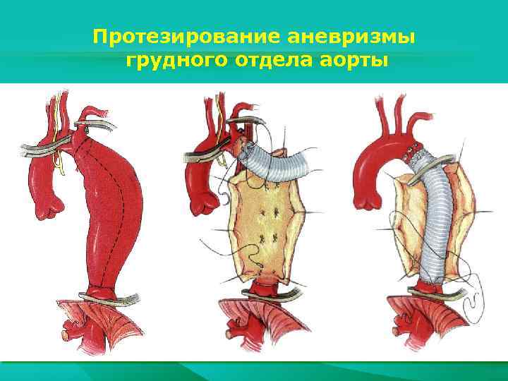 Белов руководство по сосудистой хирургии с атласом оперативной техники купить