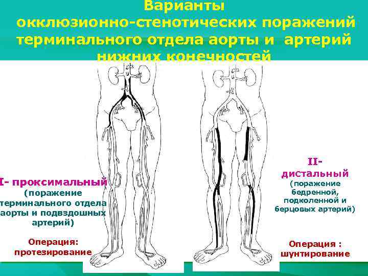 Оперативная хирургия нижней конечности презентация