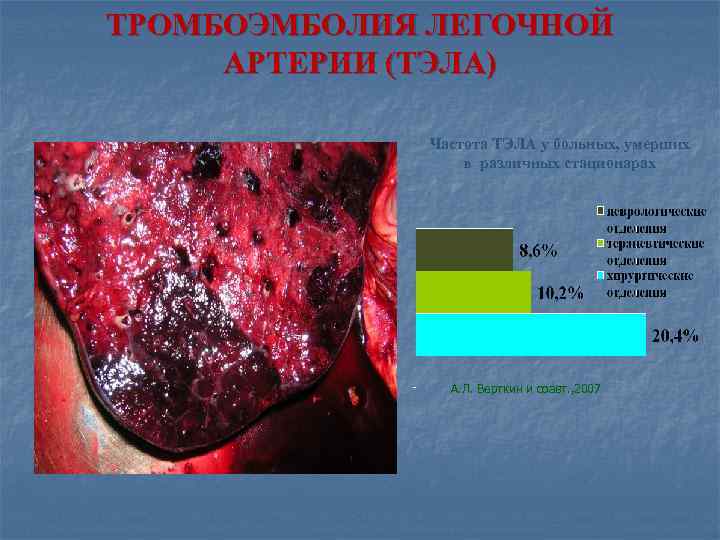 ТРОМБОЭМБОЛИЯ ЛЕГОЧНОЙ АРТЕРИИ (ТЭЛА) Частота ТЭЛА у больных, умерших в различных стационарах А. Л.