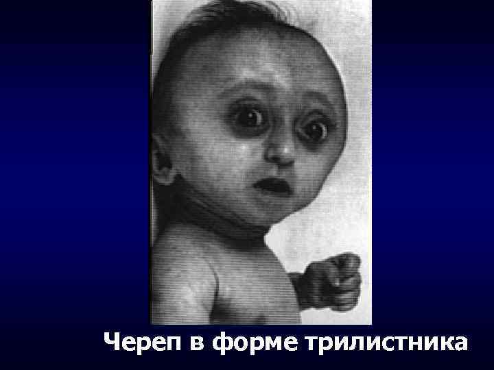 Череп в форме трилистника 