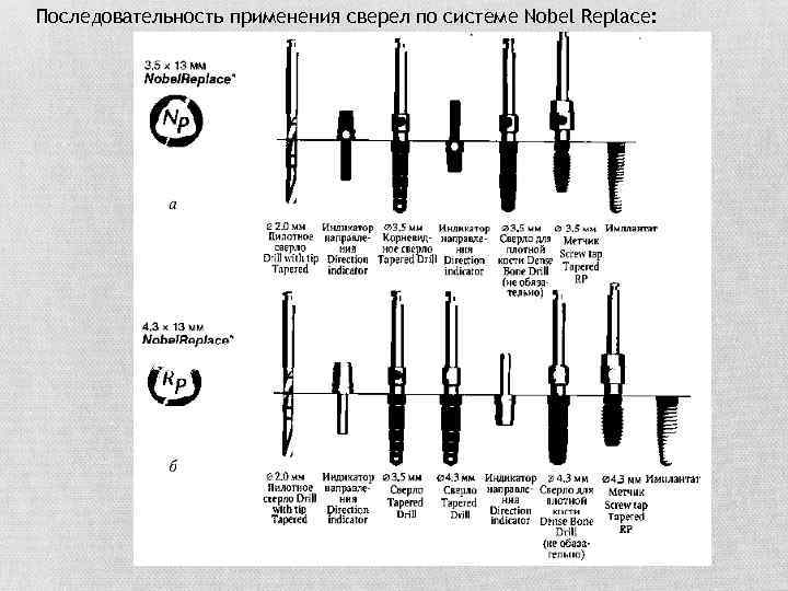 Последовательность применения сверел по системе Nobel Replace: 