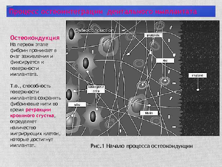 Процесс остеоинтеграции дентального имплантата Остеокондукция На первом этапе фибрин проникает в очаг заживления и