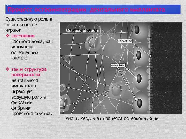 Процесс остеоинтеграции дентального имплантата Существенную роль в этом процессе играют v состояние костного ложа,