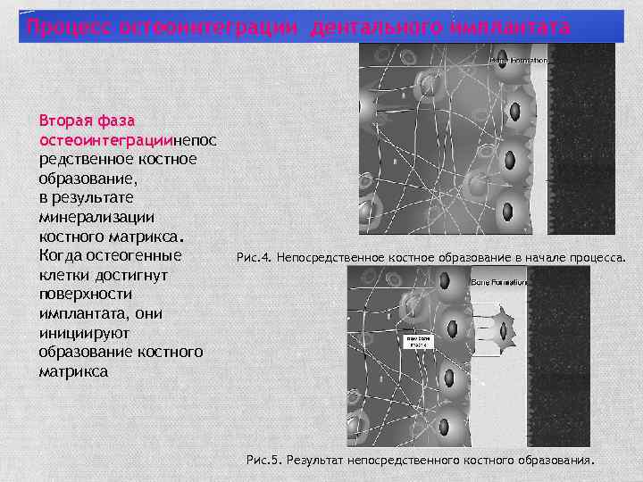 Процесс остеоинтеграции дентального имплантата Вторая фаза остеоинтеграциинепос редственное костное образование, в результате минерализации костного