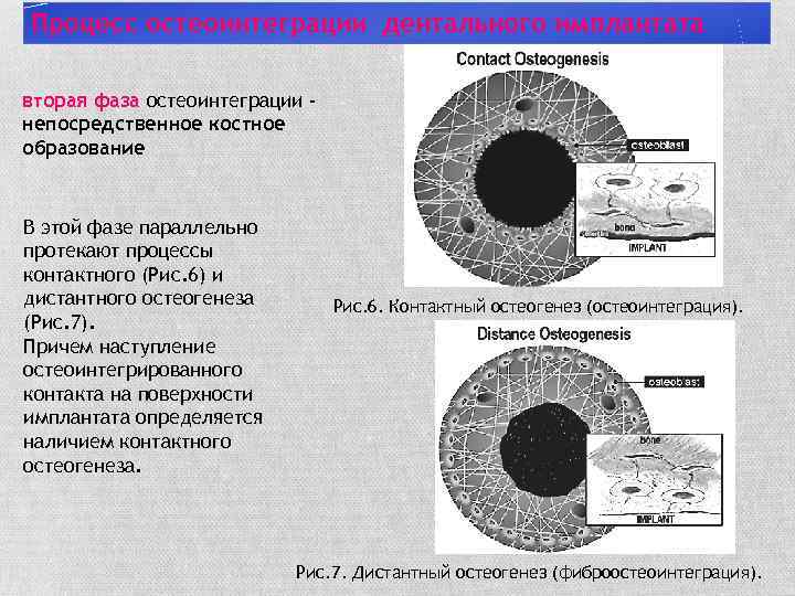 Процесс остеоинтеграции дентального имплантата вторая фаза остеоинтеграции непосредственное костное образование В этой фазе параллельно