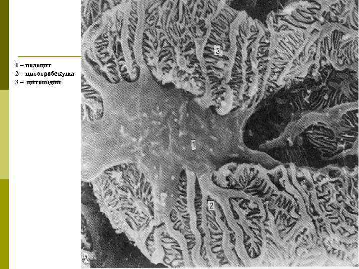 1 – подоцит 2 – цитотрабекулы 3 – цитоподии 