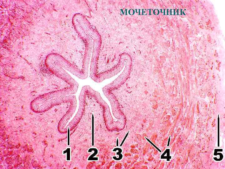 МОЧЕТОЧНИК 