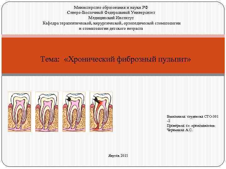 Министерство образования и науки РФ Северо-Восточный Федеральный Университет Медицинский Институт Кафедра терапевтической, хирургической, ортопедической