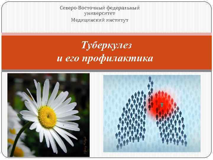 Северо-Восточный федеральный университет Медицинский институт Туберкулез и его профилактика 