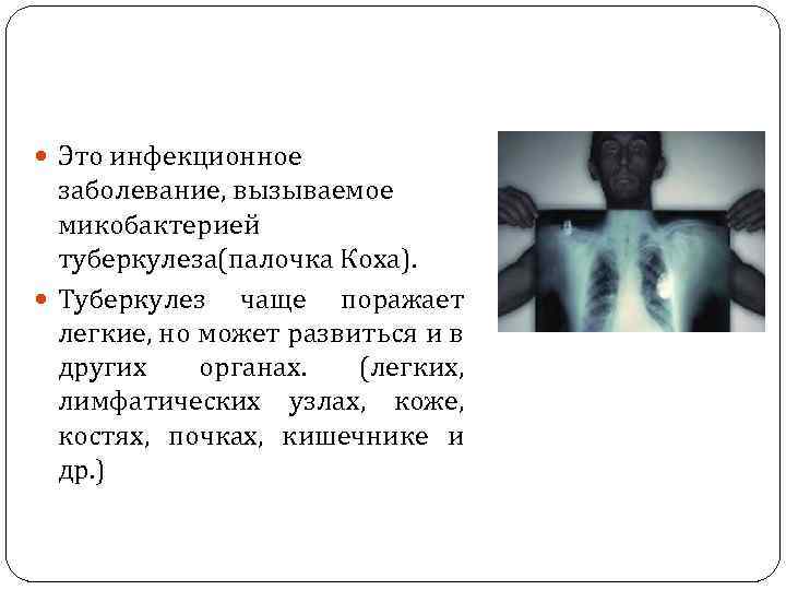  Это инфекционное заболевание, вызываемое микобактерией туберкулеза(палочка Коха). Туберкулез чаще поражает легкие, но может