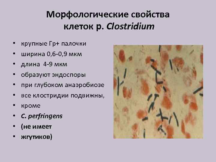 Морфологические свойства клеток р. Clostridium • • • крупные Гр+ палочки ширина 0, 6