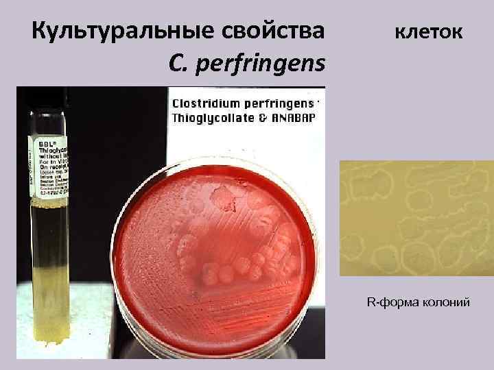 Культуральные свойства C. perfringens клеток R-форма колоний 
