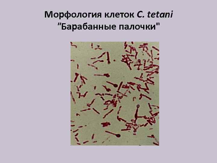 Морфология клеток C. tetani "Барабанные палочки" 