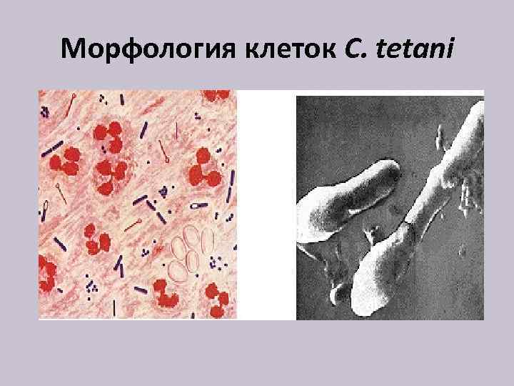Морфология клеток C. tetani 