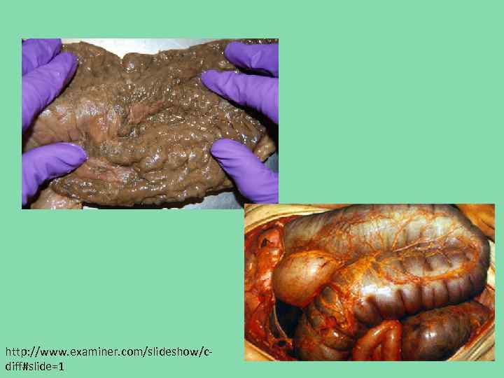 http: //www. examiner. com/slideshow/cdiff#slide=1 