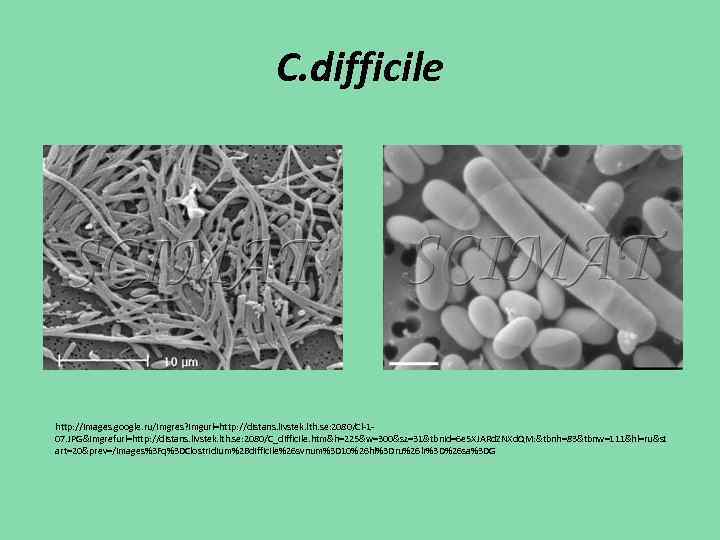 C. difficile http: //images. google. ru/imgres? imgurl=http: //distans. livstek. lth. se: 2080/Cl-107. JPG&imgrefurl=http: //distans.