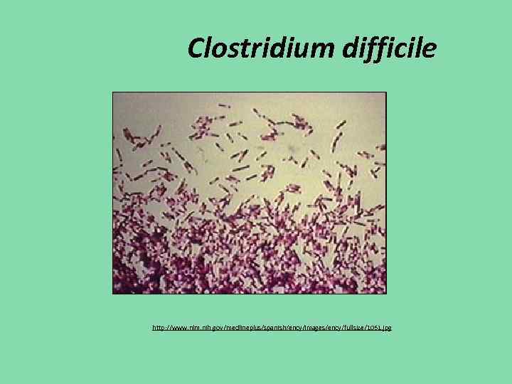 Clostridium difficile http: //www. nlm. nih. gov/medlineplus/spanish/ency/images/ency/fullsize/1051. jpg 