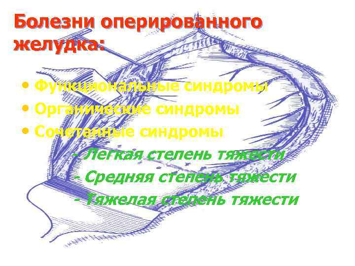 Болезни оперированного желудка: • Функциональные синдромы • Органические синдромы • Сочетанные синдромы - Легкая