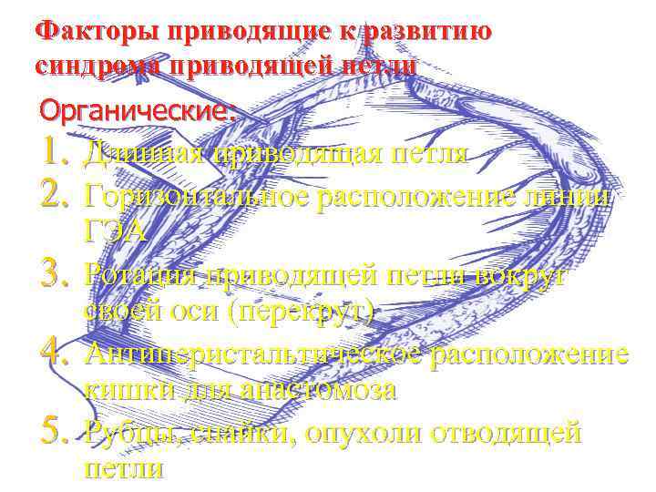 Факторы приводящие к развитию синдрома приводящей петли Органические: 1. Длинная приводящая петля 2. Горизонтальное