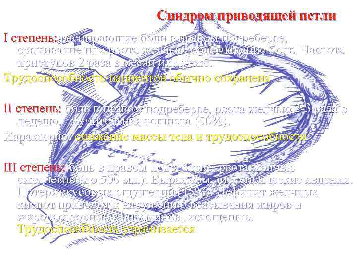 Синдром приводящей петли I степень: распирающие боли в правом подреберье, срыгивание или рвота желчью,