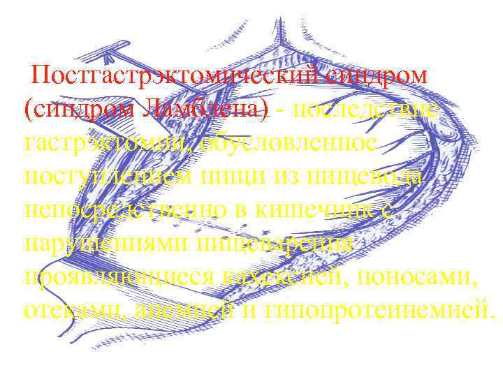  Постгастрэктомический синдром (синдром Ламблена) - последствие гастрэктомии, обусловленное поступлением пищи из пищевода непосредственно