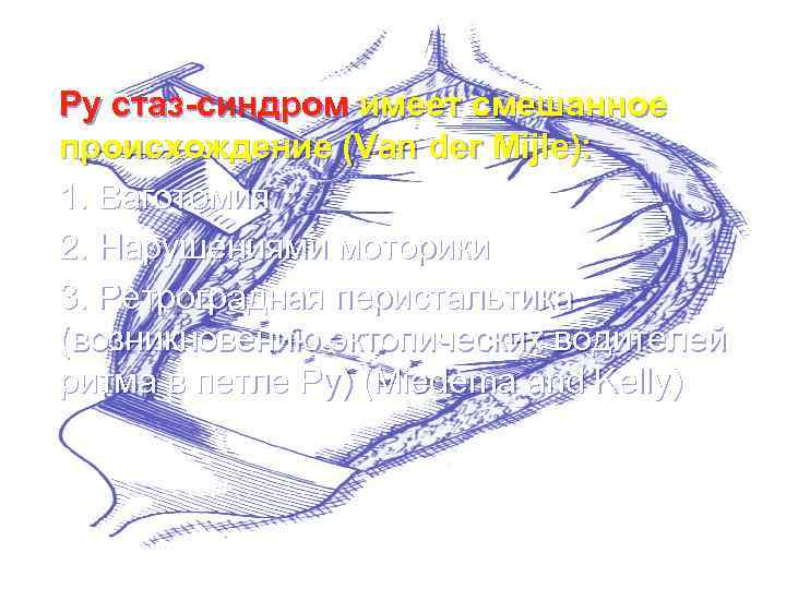 Ру стаз-синдром имеет смешанное происхождение (Van der Mijle): 1. Ваготомия 2. Нарушениями моторики 3.
