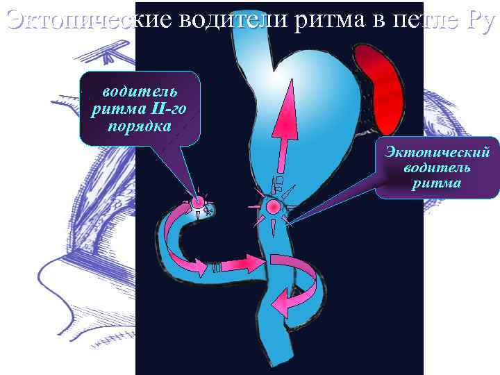 Эктопические водители ритма в петле Ру водитель pитма II-го поpядка Эктопический водитель pитма 