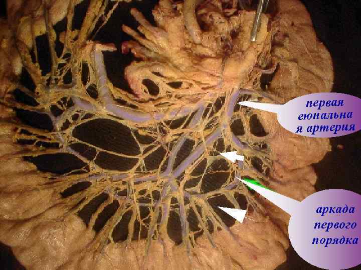 пеpвая еюнальна я аpтеpия аpкада пеpвого поpядка 