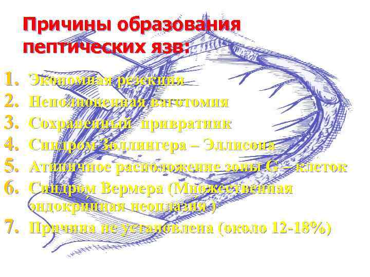 Причины образования пептических язв: 1. 2. 3. 4. 5. 6. 7. Экономная резекция Неполноценная