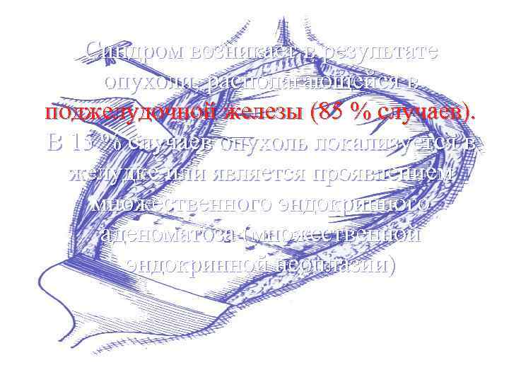 Синдром возникает в результате опухоли, располагающейся в поджелудочной железы (85 % случаев). В 15