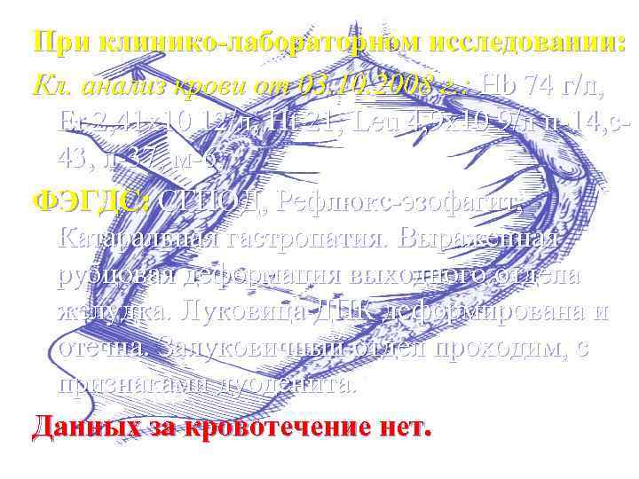 При клинико-лабораторном исследовании: Кл. анализ крови от 03. 10. 2008 г. : Hb 74