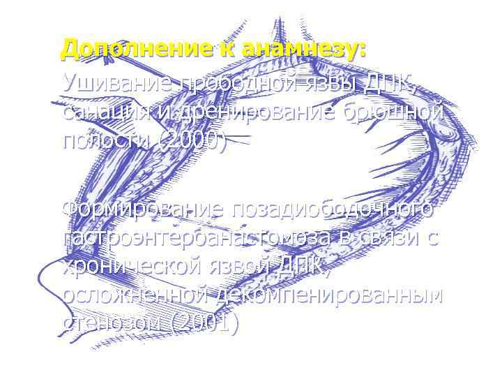 Дополнение к анамнезу: Ушивание прободной язвы ДПК, санация и дренирование брюшной полости (2000) Формирование