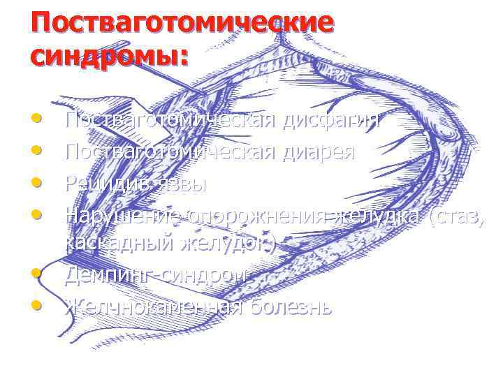 Постваготомические синдромы: • • • Постваготомическая дисфагия Постваготомическая диарея Рецидив язвы Нарушение опорожнения желудка