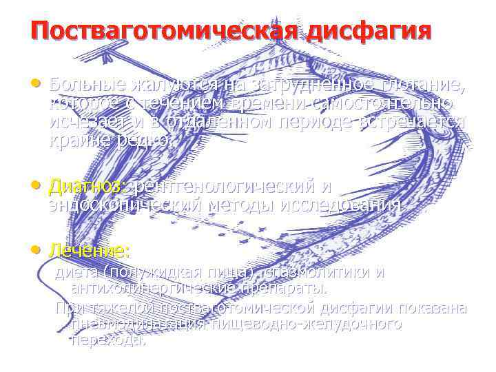 Постваготомическая дисфагия • Больные жалуются на затрудненное глотание, которое с течением времени самостоятельно исчезает