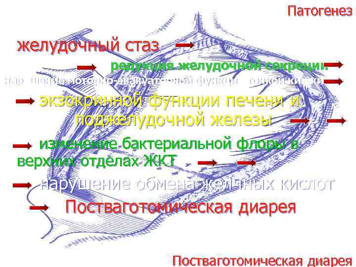 Патогенез желудочный стаз редукция желудочной секреции нарушение моторно-эвакуаторной функции тонкой кишки экзокринной функции печени