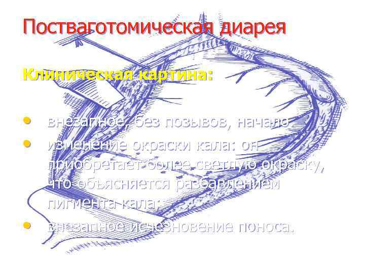 Постваготомическая диарея Клиническая картина: • внезапное, без позывов, начало. • изменение окраски кала: он