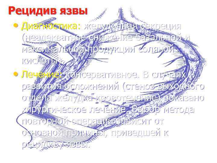 Рецидив язвы • Диагностика: желудочная секреция (неадекватное снижение базальной и максимальной продукции соляной кислоты).