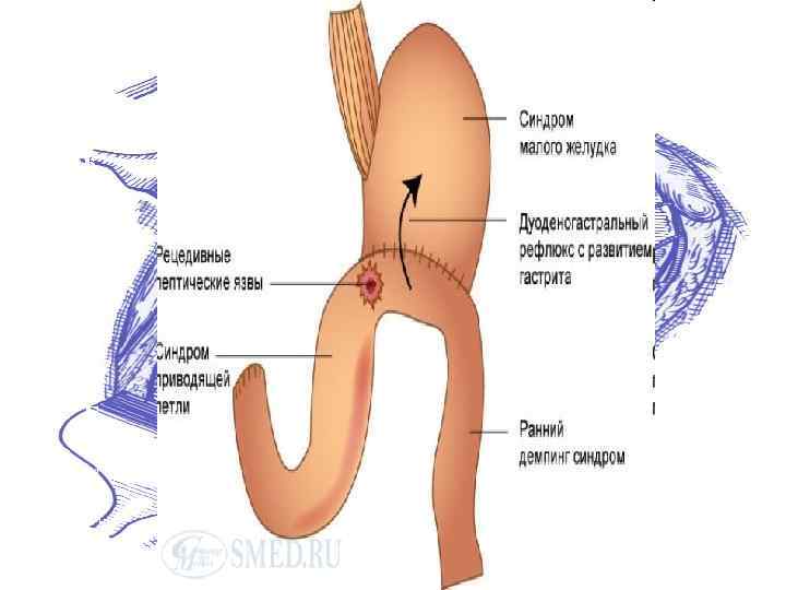  «К А С К А Д Н Ы Й» Ж Е Л У