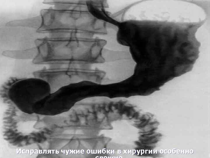 Исправлять чужие ошибки в хирургии особенно 