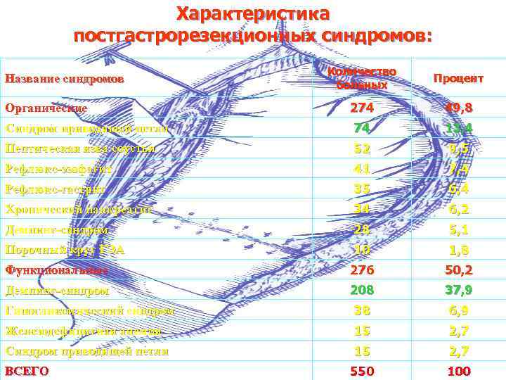 Характеристика постгастрорезекционных синдромов: Количество больных Процент 274 49, 8 Синдром приводящей петли 74 13,